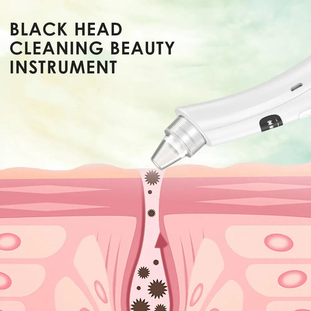 Aspirateur Points Noirs Électrique, 3 Modes d'Aspiration, Nettoyeur de Pores Visage
