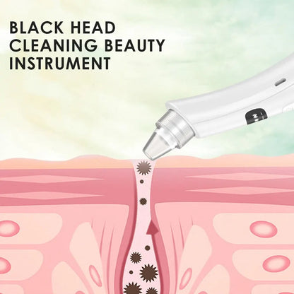 Aspirateur Points Noirs Électrique, 3 Modes d'Aspiration, Nettoyeur de Pores Visage